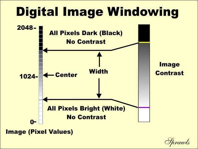 Image Display: Image Visibility The center or midpoint of the window level and