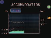 Patient-friendly Accommodation Measurement (available for the ARK-1s, ARK-1a, AR-1s, and AR-1a) Accommodation Measurement with Artificial Intelligence Algorithm Objective measurement of accommodation