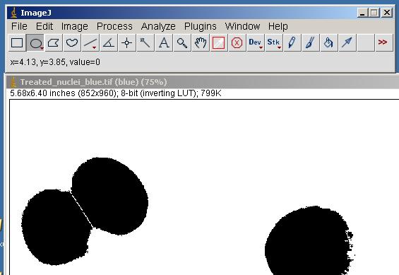 9. You can use enhancement tools such as Brightness/Contrast or Window/Level to make the particles easier to segment.