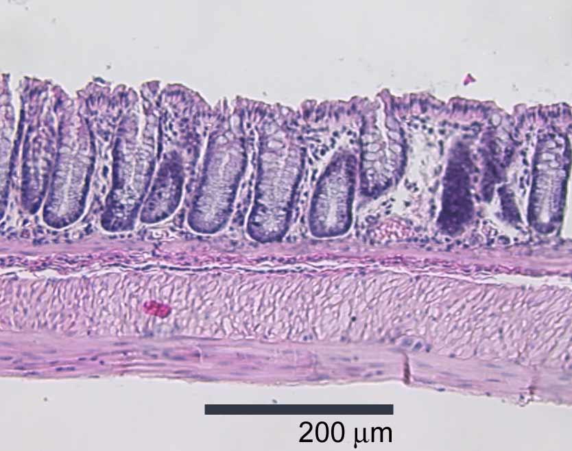 of colonic mucosa (CM), muscular mucosa (MM), submucosa (SM), muscularis externa (ME), and serosa(s) layers.
