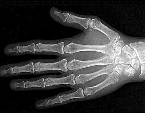X-rays OTHER IMAGING TECHNOLOGY Formed by x-rays which pass through soft tissues such as skin and muscle, but are absorbed