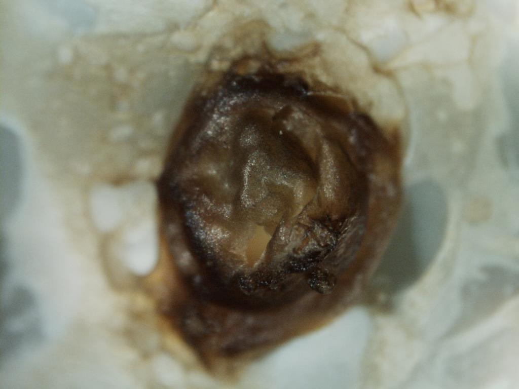 Figure 4: Close up of the brown material plugging and capping the drill hole of the 18.65 carat pearl. Magnified 21x.