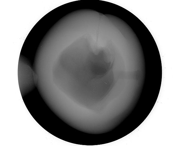 Figure 10: Microradiograph of the 18.65 ct pearl in the 3 rd orientation.