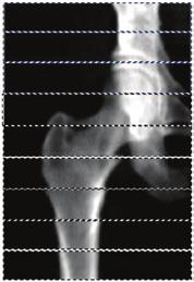 Figure 9: Multi-view image reconstruction combines bone images from each sweep to construct images at the correct bone height above the tabletop.