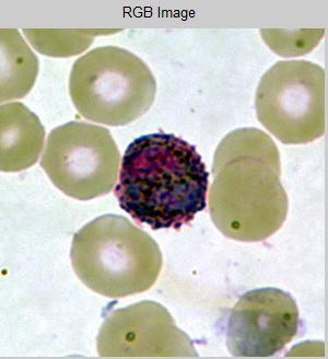 captured from the thin blood smears of p.vivax samples. Size of image is 300 900 pixels. Fig.3.1: Samples of the captured malaria images 3.