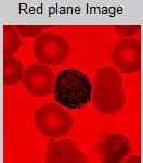 utilized to improve the image quality and contrast of malaria image as show in result. Fig.3.2: contrast enhancement 3.