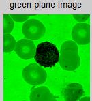 condition can cause variations in malaria images, selection of color component is very important as this step may ease the parasite detection and