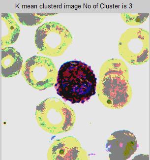 cells background. The k means is a clustering method which is one of the most popular unsupervised learning algorithms due to its simplicity. Fig.3.