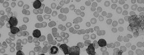 leukocytes groups and produces a binary image showing the individual leukocytes and a binary image showing the adjacent leukocytes.