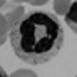 The mask obtained makes it possible to extract clearly the leukocytes nucleus.