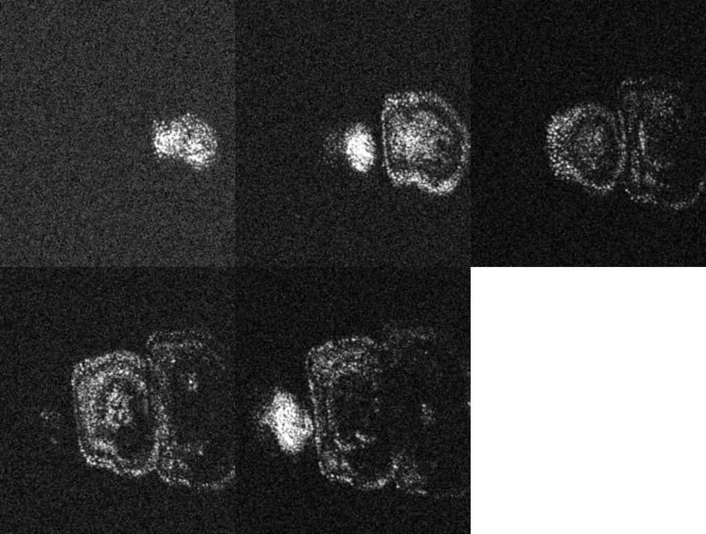 Fig. 6. A) A montage of en-face OCT images of armadillidium vulgare dorsal side simultaneously acquired with five imaging channels operating at 69, 74, 79, 84 and 89 MHz. B).