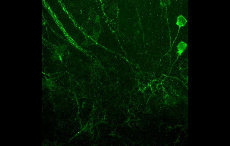 Zebrafish Neurons 100 um
