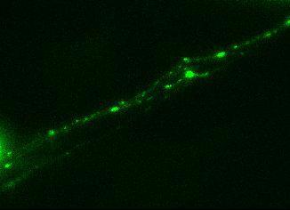 Z Series Collected on Timed Intervals Max projections of Z series timelapse,rab5-gfp vesicles in axons within spinal