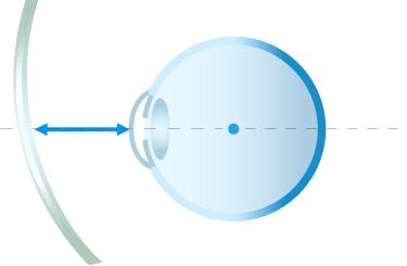 Far vision Intermediatevision Vertex= 12mm Pantoscopic angle = 8 Wrap angle= 7 Nearvision This power variation causes aberrations, needing a training period.