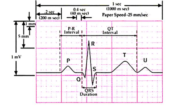 Fig Normal ECG Waveform II. METHODOLOGY Fig. 1 depicts the stages of the proposed algorithm for heartbeat classification schema.