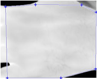 entire dorsal of the hand has been selected as shown in Fig 5. After 100 iterations, it has been clearly outlined the contour of our trait (ROI) as shown in Fig 6. Fig. 7 depicts the code in MATLAB for the iterations.
