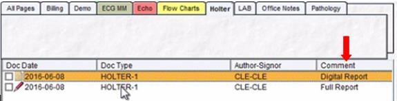 6. The Full PDF Report will be filed in the chart under the Holter Chart Tab. a. Note: if the Holter s raw data (.