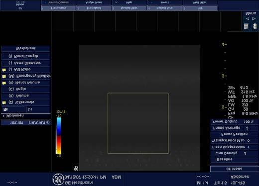 Reduce the ROI to the smallest reasonable size. Position the Focal Zones properly. To decrease motion artifact: Increase the PRF. Increase the Wall Filter. To eliminate aliasing: Increase the PRF.