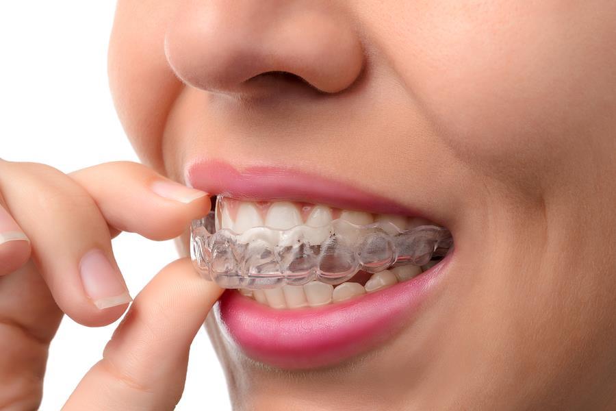 3 ARE RETAINERS INCLUDED IN TREATMENT? Each orthodontic practice has its own set of treatment fees, and doctors often charge based on the various procedures.