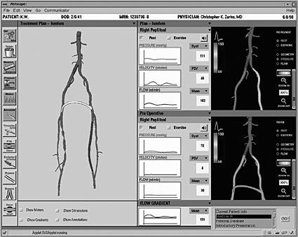 Example Example Researchers funded by the joint NASA-Stanford University Center for Turbulence Research are using MRI data to create computer simulations of blood flow through vessels of patients