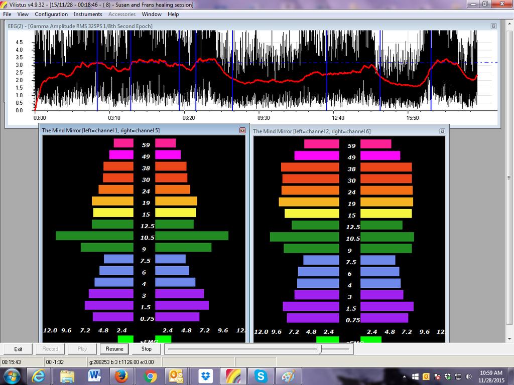 Segment #8 Mind Mirror Summary Patterns: Susan and Frans The above screen capture shows a black-on-white horizontal Gamma Amplitude window below which are Mean brainwave patterns averaged over the