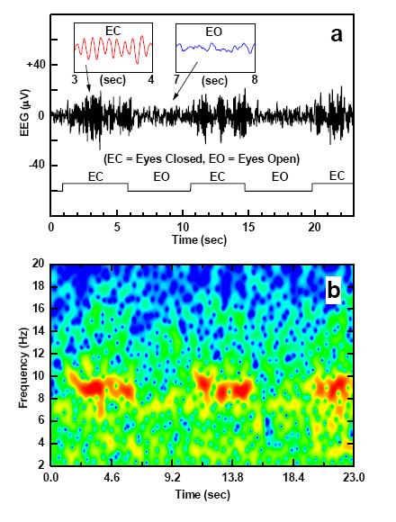 Body electrophysiology EEG contact mode EEG from occipital region of brain showing α-blocking Joint time-frequency spectrogram (red regions show α rhythm) Remote detection of