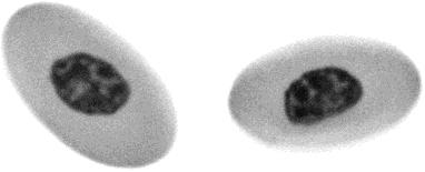 302 ZUCKER AND PRICE FIG. 8. CRBCs stained with AO. The images were obtained with a 100 Plan Apo lens (NA 1.4) using 488 laser light excitation and a band pass of 505 555 for emission.