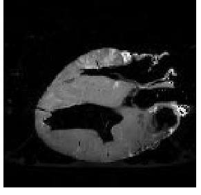 MRI scan of canine heart, and find boundaries between types of tissue with