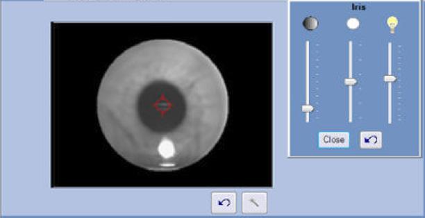 To capture the best quality image, instruct the patient to: Keep chin down Keep teeth together Place forehead against the forehead rest Move with the chinrest If the iris image is dark, click on the