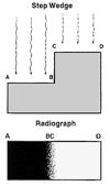 General Principles of Radiography Radiographic definition is the abruptness of change in going from one density to another.