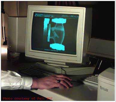 Computed Radiography Digital images