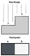 General Principles of Radiography Contrast: The first subjective criteria for determining radiographic quality is
