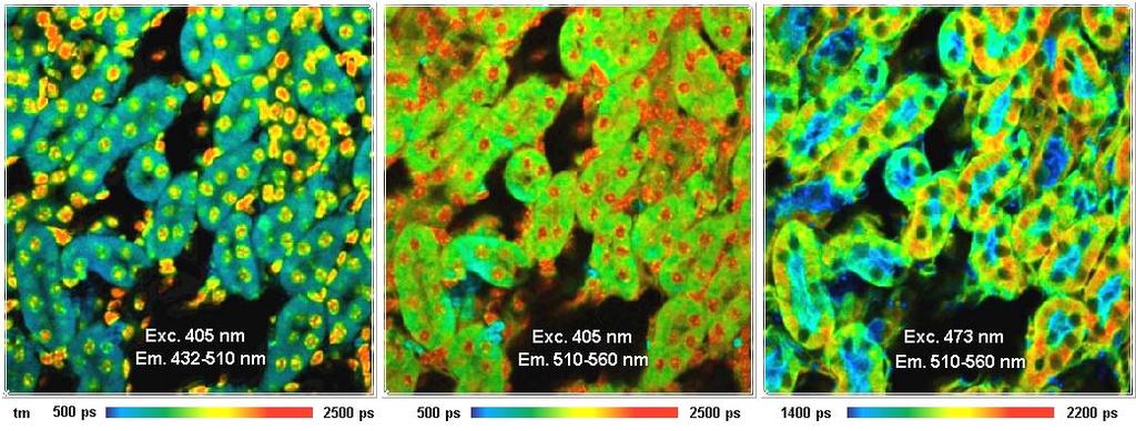 Confocal FLIM with NIR fluorophores Excitation by ps diode lasers,