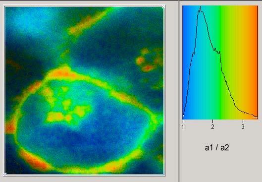 fluorescence lifetime images Record metabolic