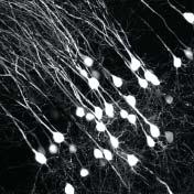 Masanori Takahashi, Division of Developmental Neuroscience, Tohoku University Graduate School of Medicine Fixed neuronal cells of mouse brain expressing egfp Excitation with pulsed IR laser (920 nm)