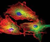 Powerful results from advanced confocal imaging Triple staining Triple staining of pulmonary artery endothelial