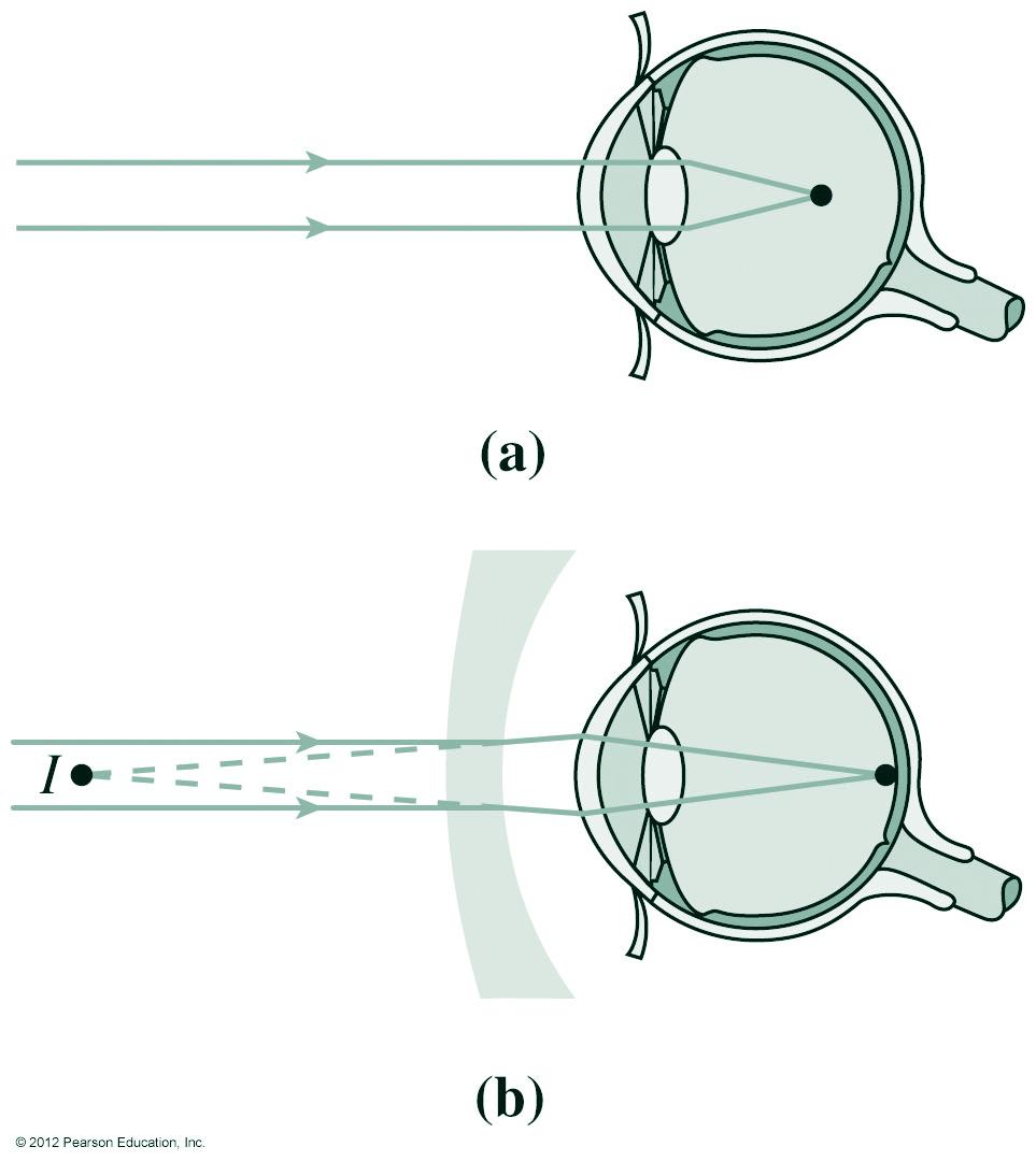 The power of corrective lenses is measured in diopters: P = 1/f, with f measured in meters.