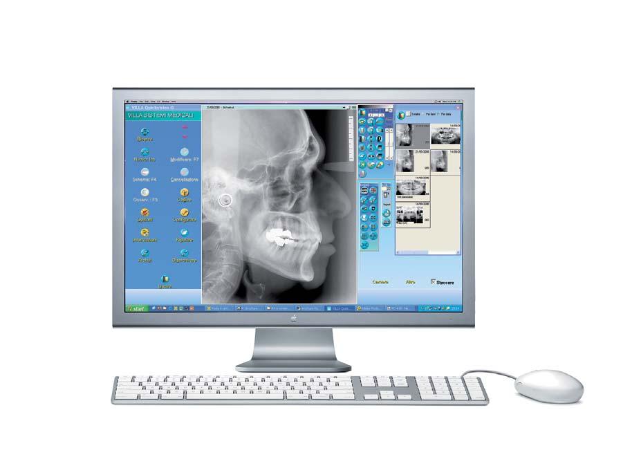 Carpus Exam Bone age can be assessed with the dedicated Carpus Exam. A dedicated hand support plate makes positioning fast and easy.