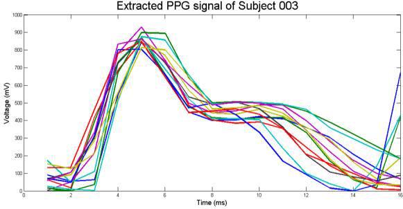 Next, after the feature extraction stage, an extracted PPG signal were obtained from the filtered signals that consists of systolic and diastolic regions that act as the biometric sample.