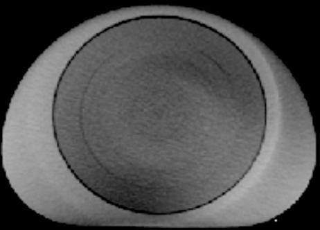 28 Mail et al.: The influence of bowtie filtration on cone-beam CT image quality 28 456789: ( ( $ '!