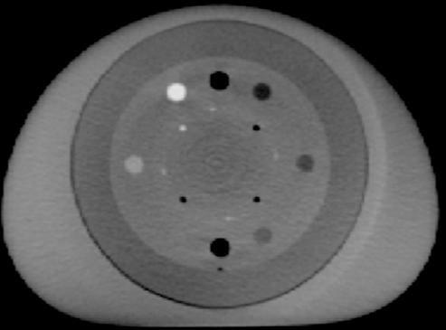 5 d is due to lag and ghosting 16 not due to the compatibility of the bowtie filter for an irregular shaped. The shoulder on the right hand side of Fig. 5 d is magnified in Fig.