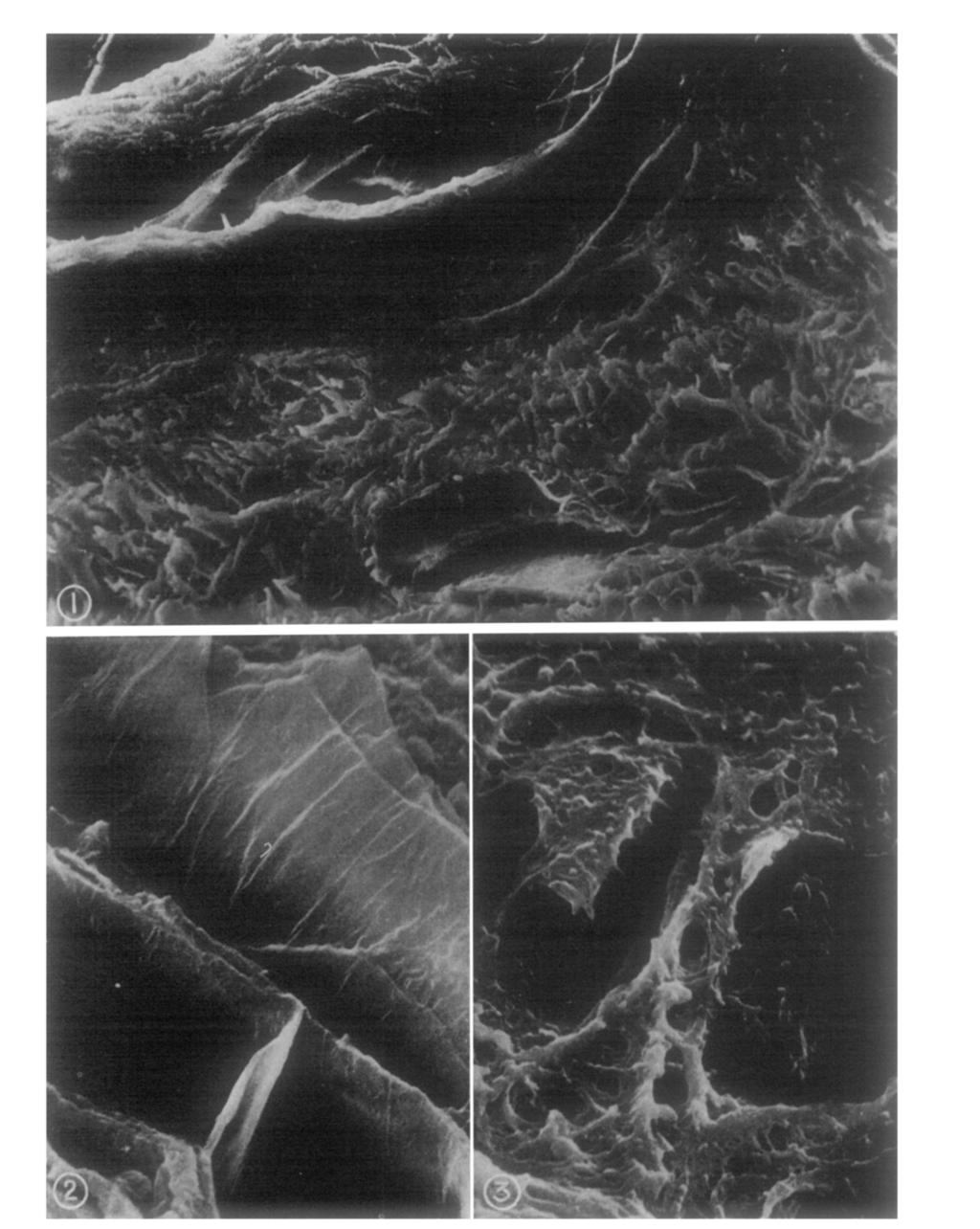 Fig. r.--low-power scanning micrograph of section of h u m a n skin, normal to the surface. keratinised layer and the epidermis and dermis can be made out. 3oo. The Fig. 2.