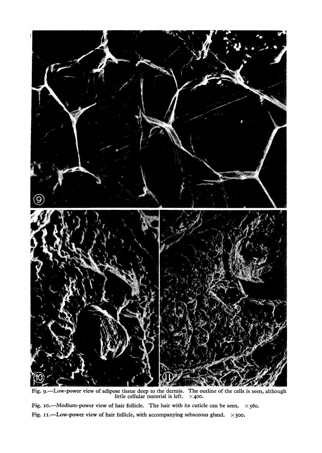 Fig. 9.--Low-power View of adipose tissue deep to the dermis.