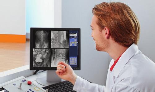 The result is a consistent and efficient fully digital workflow across all Siemens radiography and fluoroscopy systems.