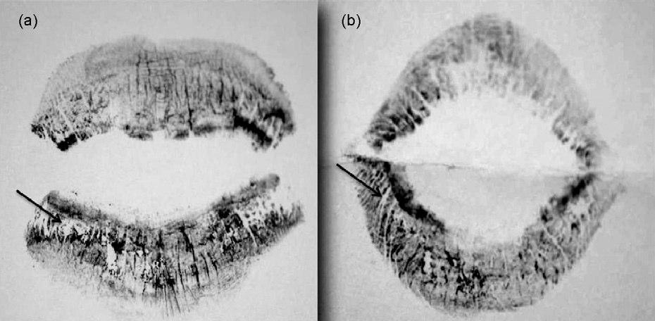 Effect of dry weather (a) The first taken lip print from the
