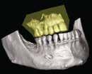 longitudinal 2D view, you can plan your perfect implant