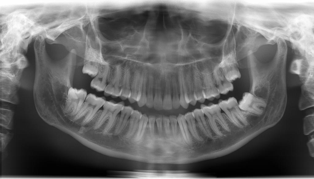 is oriented to the actual position of the teeth, false Here, the image areas that match best with the actual positioning is evened out to a certain extent.