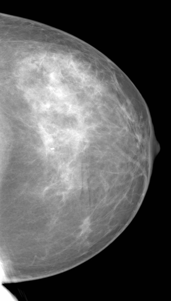 Properties of image Bit depth (9 bits or higher for digital mammogram) Grayscale or