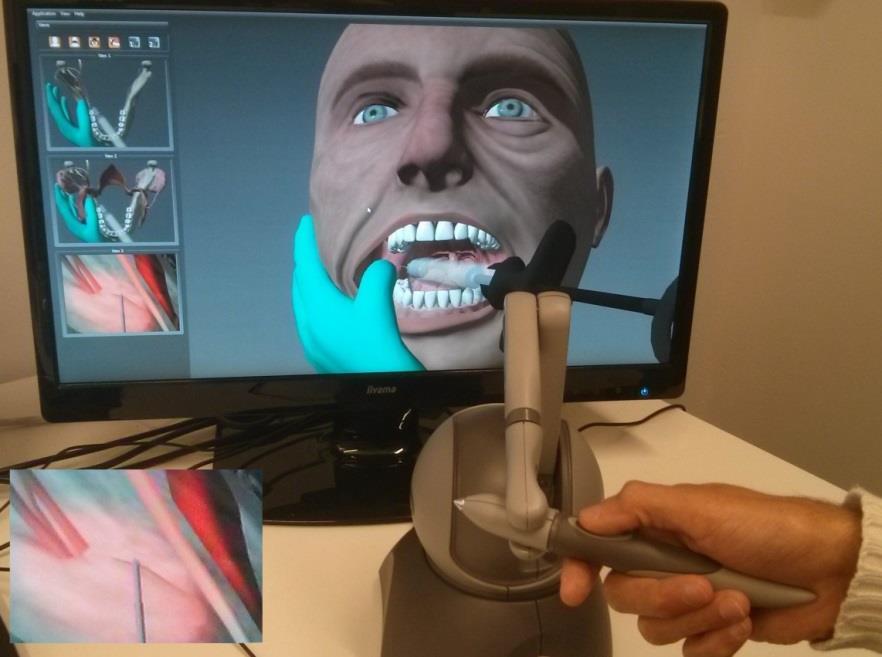 8 Google Glass demo in surgery. Figure taken from [56]. Fig. 9 Demonstrations of how to use virtual reality and haptic feedback to train a dentist. Figure taken from [57]. 2.3.