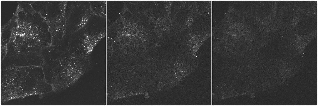 2 photon versus confocal microscopy POP go the endosomes One photon image at
